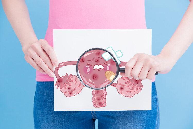 女子把子宫切除后健康吗？全面解读与关注